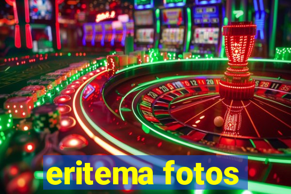 eritema fotos